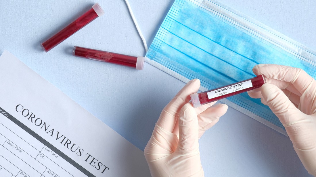 Coronavirus România: 15.588 de cazuri confirmate, 7.245 vindecate, 972 decese