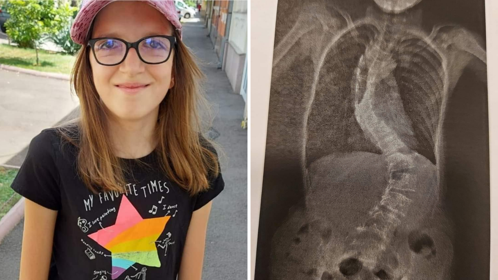 Este din Arad, are 12 ani și tot ce își dorește este să fie un copil normal