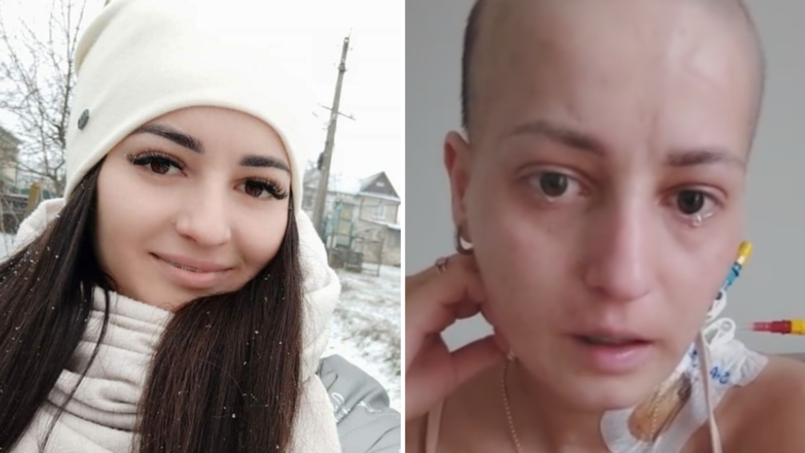 Două imagini, același suflet. De la o simplă răceală, Alexandrina a ajuns la un diagnostic care i-a schimbat viața