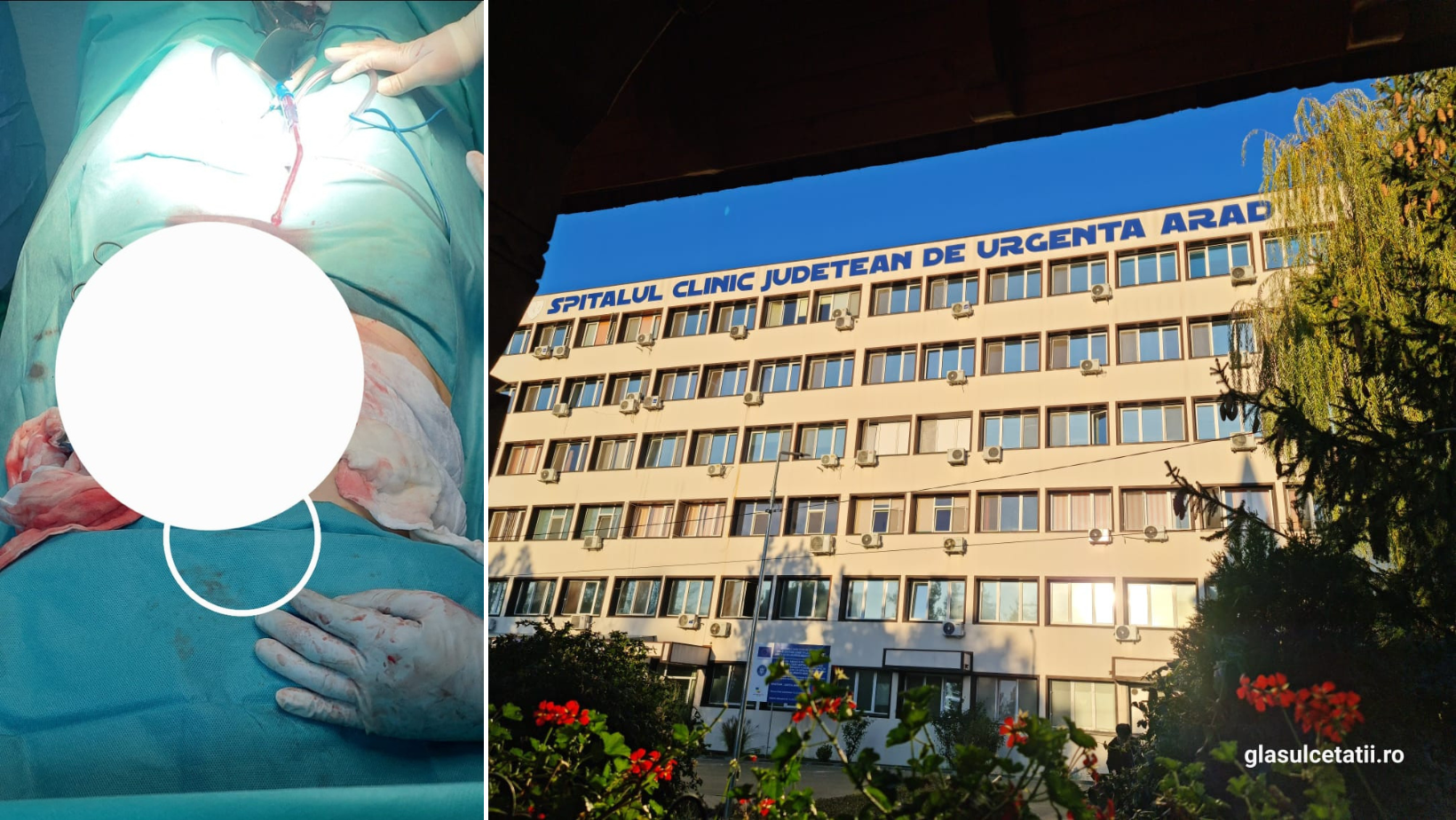 Medicii arădeni au extirpat cu succes o tumoră de aproape 10 kg de la o pacientă de 50 de ani