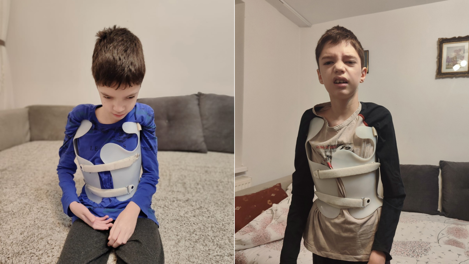 Respirația unui copil de 13 ani depinde de o intervenție chirurgicală care nu mai poate fi amânată